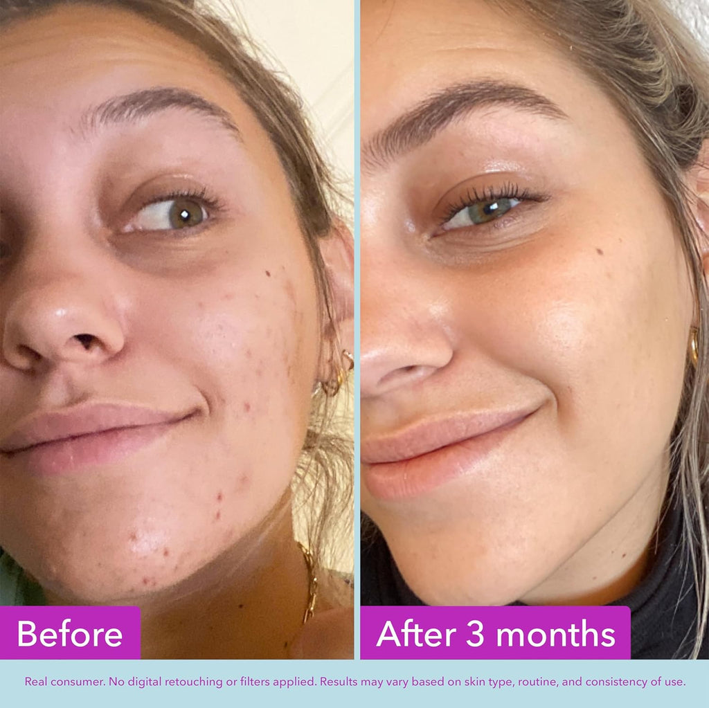 Good Molecules Niacinamide Brightening Toner - Toner for Face with Niacinamide and Arbutin for Skin Tone Balancing - Minimizes the Look of Pores, Skin Care for Face