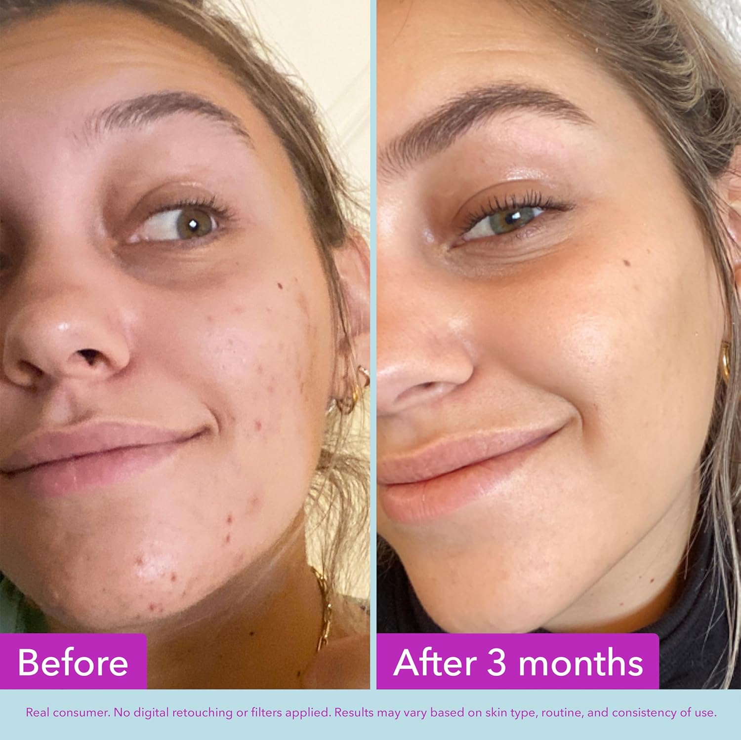 Good Molecules Niacinamide Brightening Toner - Toner for Face with Niacinamide and Arbutin for Skin Tone Balancing - Minimizes the Look of Pores, Skin Care for Face